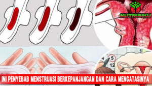 Ini Penyebab Menstruasi Berkepanjangan dan Cara Mengatasinya